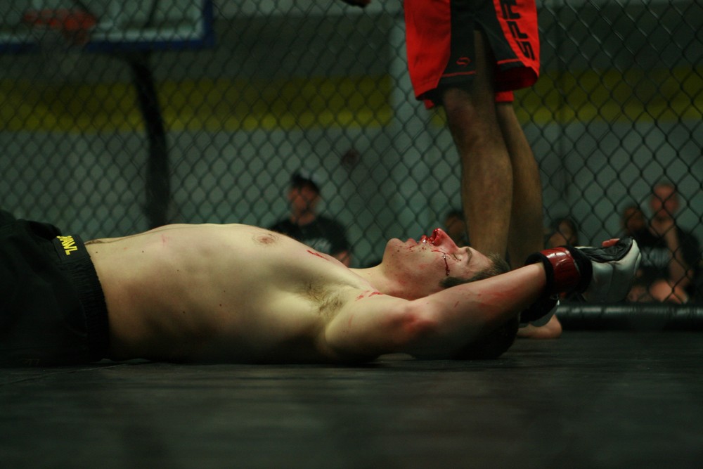 Boxer laying on the canvas after fight